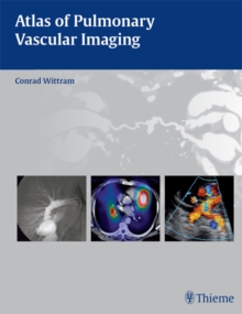 Atlas of Pulmonary Vascular Imaging