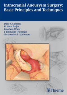 Intracranial Aneurysm Surgery : Basic Principles and Techniques