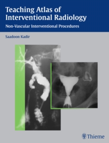 Teaching Atlas of Interventional Radiology : Non-Vascular Interventional Procedures