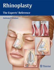 Rhinoplasty : The Experts' Reference