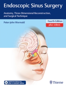 Endoscopic Sinus Surgery : Anatomy, Three-Dimensional Reconstruction, and Surgical Technique