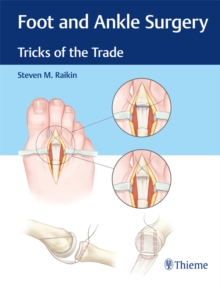 Foot and Ankle Surgery : Tricks of the Trade