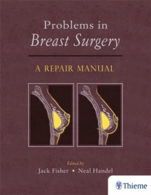 Problems in Breast Surgery : A Repair Manual