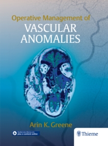 Operative Management of Vascular Anomalies