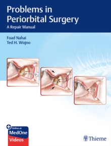 Problems in Periorbital Surgery : A Repair Manual