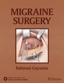 Migraine Surgery