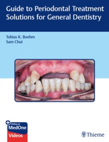 Guide to Periodontal Treatment Solutions for General Dentistry