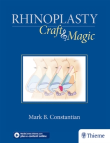 Rhinoplasty : Craft and Magic