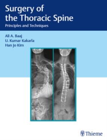 Surgery of the Thoracic Spine : Principles and Techniques