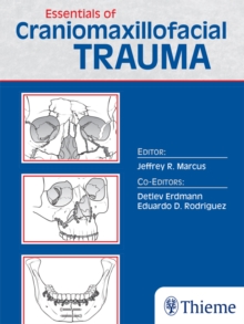 Essentials of Craniomaxillofacial Trauma