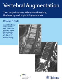 Vertebral Augmentation : The Comprehensive Guide to Vertebroplasty, Kyphoplasty, and Implant Augmentation