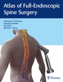 Atlas of Full-Endoscopic Spine Surgery