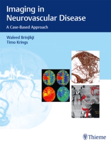 Imaging in Neurovascular Disease : A Case-Based Approach