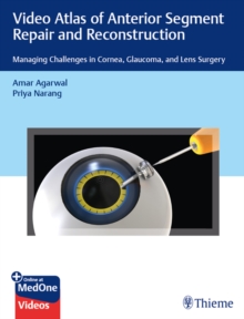 Video Atlas of Anterior Segment Repair and Reconstruction : Managing Challenges in Cornea, Glaucoma, and Lens Surgery