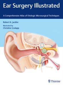 Ear Surgery Illustrated : A Comprehensive Atlas of Otologic Microsurgical Techniques