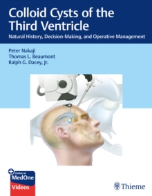 Colloid Cysts of the Third Ventricle : Natural History, Decision-Making, and Operative Management