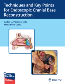 Techniques and Key Points for Endoscopic Cranial Base Reconstruction