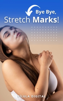 Bye Bye, Stretch Marks! : Guide to treating stretch marks