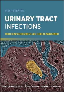 Urinary Tract Infections : Molecular Pathogenesis and Clinical Management