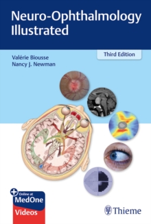 Neuro-Ophthalmology Illustrated