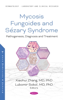 Mycosis Fungoides: Causes, Diagnosis and Treatment