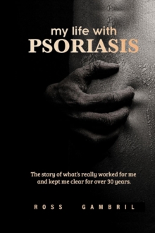 my life with PSORIASIS : The story of what finally worked for me and kept me clear for over 30 years!