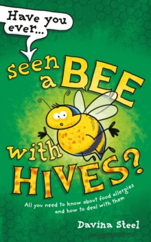Have You Ever Seen a Bee with Hives? : All you need to know about food allergies and how to deal with them