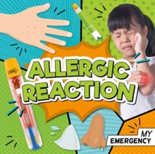 Allergic Reaction