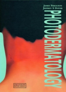 Photodermatology, Hardback Book Photodermatology, Hardback Book