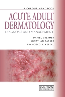 Acute Adult Dermatology : Diagnosis and Management: A Colour Handbook, EPUB eBook Acute Adult Dermatology : Diagnosis and Management: A Colour Handbook, EPUB eBook