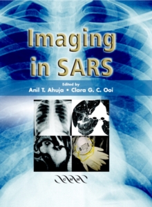 Imaging in SARS, Hardback Book Imaging in SARS, Hardback Book