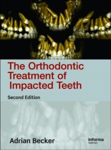 Orthodontic Treatment of Impacted Teeth,Second Edition, Hardback Book Orthodontic Treatment of Impacted Teeth,Second Edition, Hardback Book