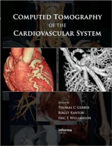 Computed Tomography of the Cardiovascular System, Hardback Book Computed Tomography of the Cardiovascular System, Hardback Book