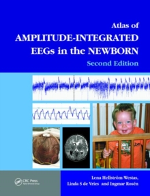 An Atlas of Amplitude-Integrated EEGs in the Newborn