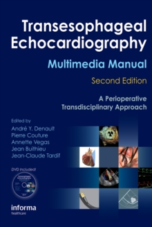 Transesophageal Echocardiography Multimedia Manual : A Perioperative Transdisciplinary Approach