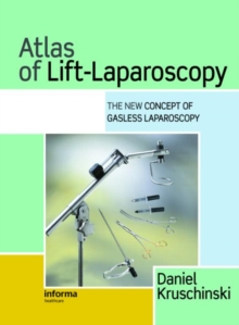 Atlas of Lift-Laparoscopy : The New Concept of Gasless Laparoscopy, Hardback Book Atlas of Lift-Laparoscopy : The New Concept of Gasless Laparoscopy, Hardback Book