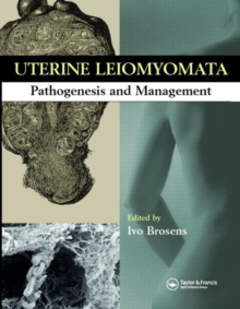 Uterine Leiomyomas : Pathogenesis and Management, Hardback Book Uterine Leiomyomas : Pathogenesis and Management, Hardback Book