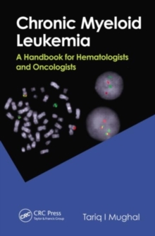 Chronic Myeloid Leukemia : A Handbook for Hematologists and Oncologists