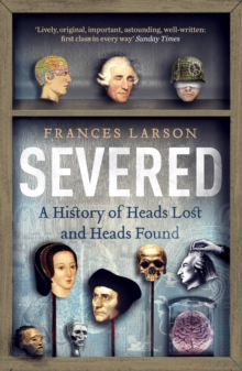 Severed : A History of Heads Lost and Heads Found