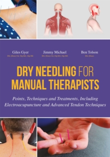 Dry Needling for Manual Therapists : Points, Techniques and Treatments, Including Electroacupuncture and Advanced Tendon Techniques