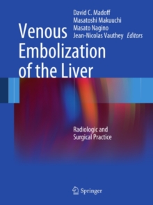 Venous Embolization of the Liver : Radiologic and Surgical Practice