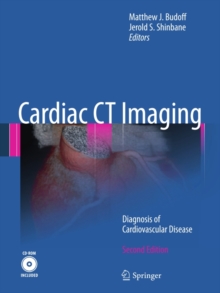 Cardiac CT Imaging : Diagnosis of Cardiovascular Disease