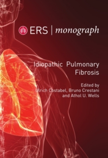 Idiopathic Pulmonary Fibrosis