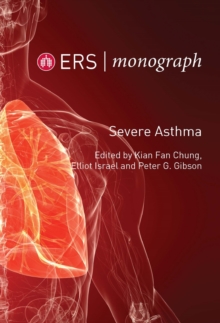 Severe Asthma