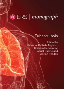 Tuberculosis