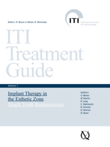 Implant Therapy in the Esthetic Zone : Single-Tooth Replacements