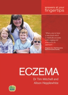 Eczema : The 'At Your Fingertips' Guide, Paperback Book Eczema : The 'At Your Fingertips' Guide, Paperback Book
