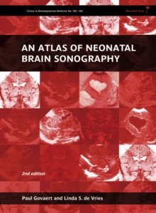 An Atlas of Neonatal Brain Sonography, 2nd Edition