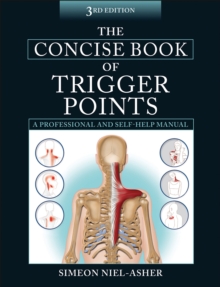 The Concise Book of Trigger Points