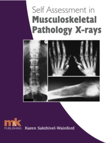 Self Assessment in Musculoskeletal Pathology X-rays